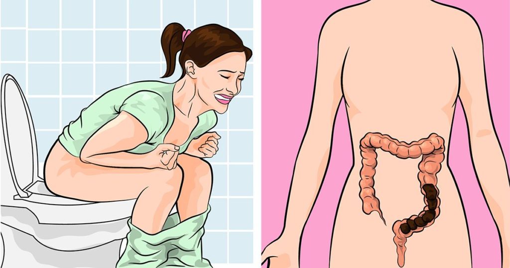 10 Major Causes of Constipation and Remedy